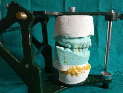 Showing the mock surgery