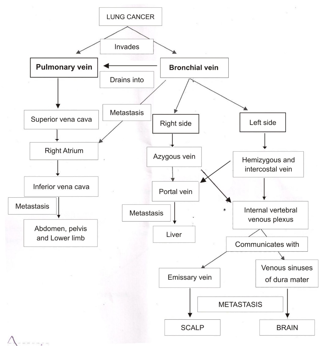 Venous spread of lung cancer
