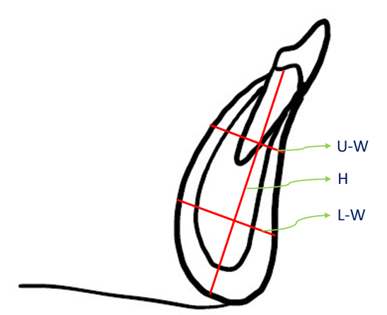 Linear measurements of the mandibular symphysis