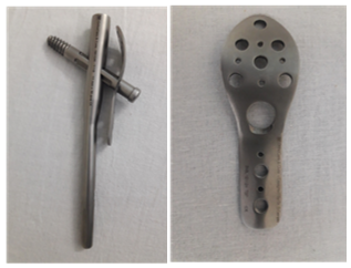 Trochanteric but tress plate for Hip fixation nail
