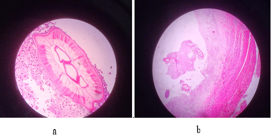 a; and b; showing cross section of the Dirofilarial worm surrounded by mixed inflammatory infiltrates