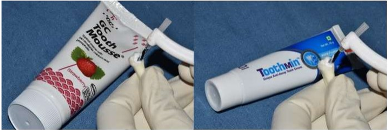 Application of Remineralisation pastes