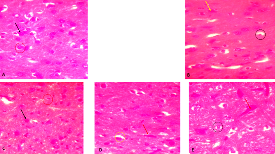 Effect of Glibenclamide, Catechin, and Ethanolic Neem Leaf Extract on Hypothalamus and Feeding Pattern in Alloxan-Induced Diabetic Rats