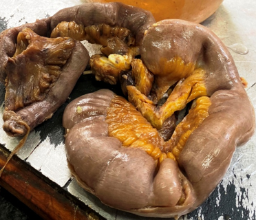 On gross ileumexternally showing thicken wall, ischemic changes and enlarged nodes.