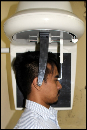 Individual positioned within the Cephalostat for Lateral Cephalogram in profile view.