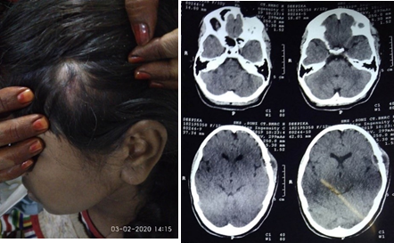 Showing characteristics of Hemangiomas