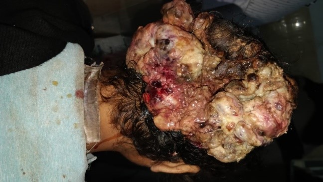  Showing clinical appearance of ES
