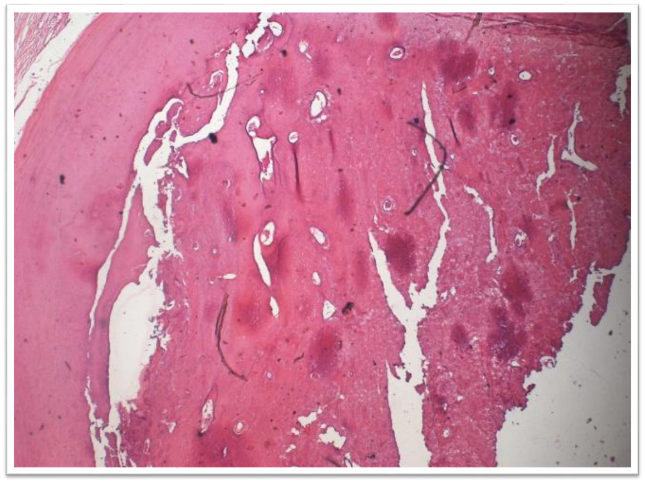 Histopathological picture