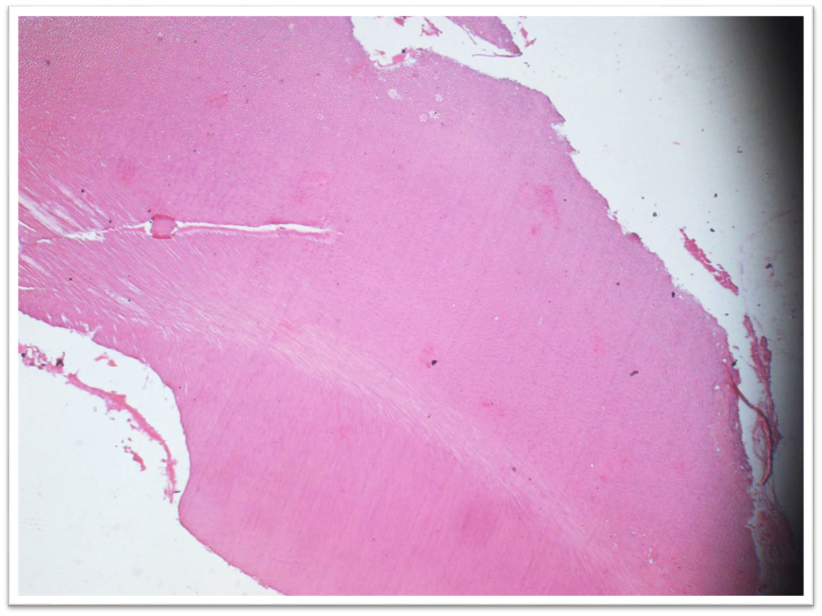 Histopathological picture at 20x