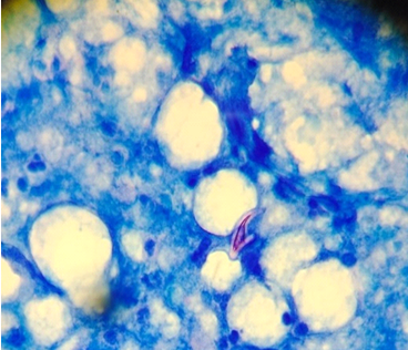 Photomicrographs showing Hooklets of Ecchinococcus granulosus (AFB 100 X)