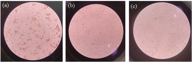 Microscopic image of hemolysis (a) positive control (b) 10µg/ml concentration and (c) 1000µg/ml concentration.