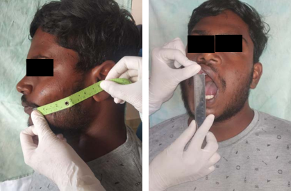 Assessment of swelling and mouth opening.