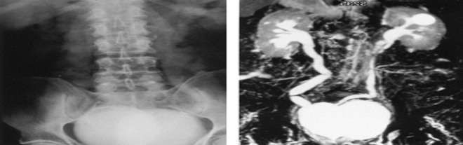 MRU Images (Image adopted from https://www.sciencedirect.com/science/article/pii/S0090429598002180)