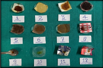 Group A3: Study items subjected to 0.5 ml of Lugol’s iodine solution after a period of 48 hours and colour change is noted.