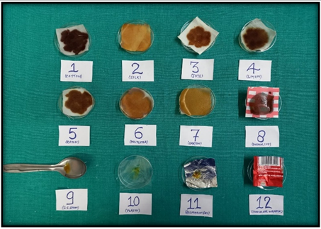 Group C: Study items washed thoroughly with alcohol allowed to dry at room temperature and subjected to Lugol’s iodine solution and colour change is noted.