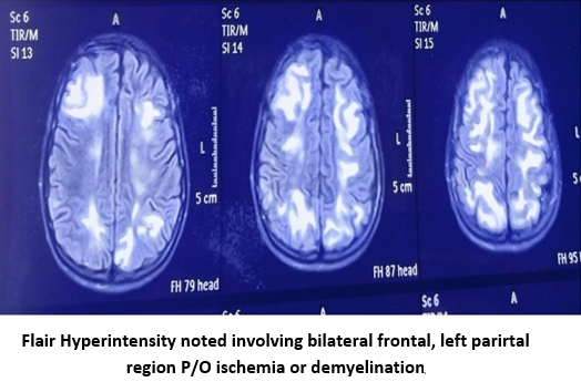 MRI brain