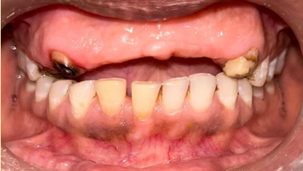 Clinical pre-operative photograph
