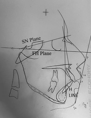 Planes used in the study 