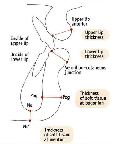 Soft tissue structures