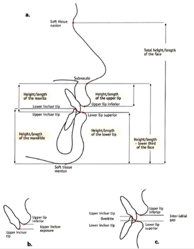Facial lengths