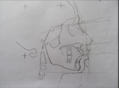 Tracings of soft tissue parameters.