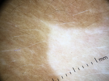 Comet tail appearance