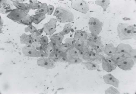 Normal Buccal Smear(PAP Stain)
