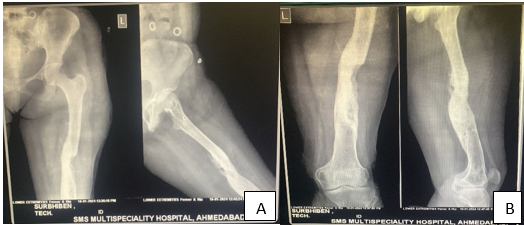 Follow up x-ray after 3 months and 6 months respectively.