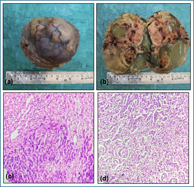 Histomorphological Patterns of Ovarian Lesions with Special Emphasis on Rare Ovarian Tumors in a Tertiary Care Center