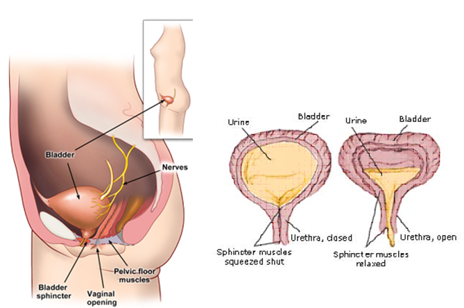 (a) Normal pelvic anatomy of bladder and female urethra; (b) bladder and urethra cut-section in which sphincter muscles are squeezed and shut; (c) bladder and urethra cut-section in which sphincter muscles are relaxed
