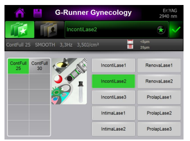 Applications library screen for the second step of the G-runner IncontiLase Treatment protocol with GClear25 speculum. The image at the centre of the screen shows the correct configuration of the components needed for this step