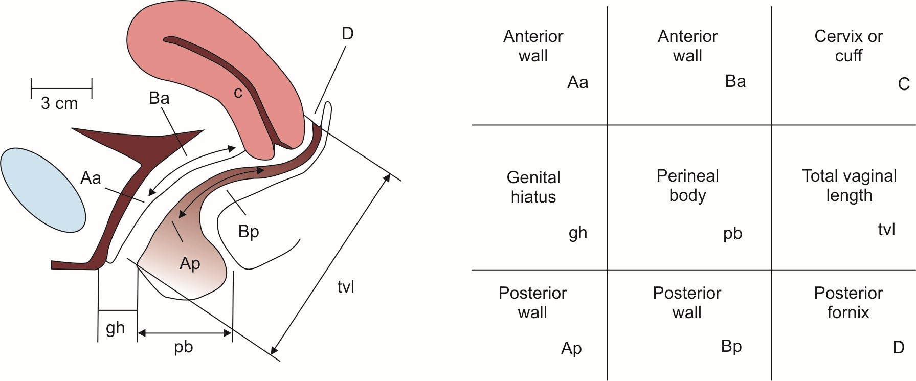 Pelvic organ prolapse quantification system - measurements of the POP-Q parameters and their representation