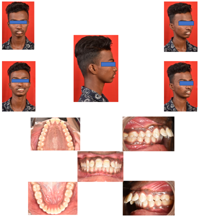 Pre-treatment photographs