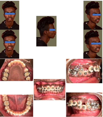 MID treatment photographs