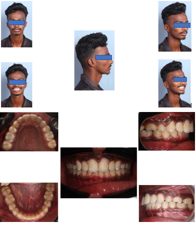 Post treatment photographs