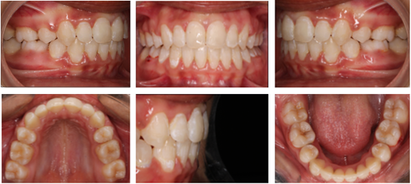 Post- treatment intra- oral photographs