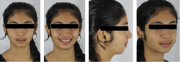Post- treatment extra- oral photographs