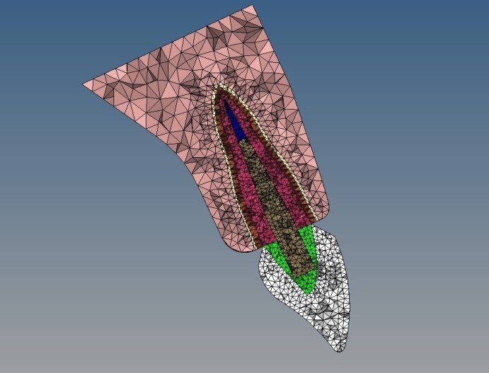 Cross section of the model after meshing