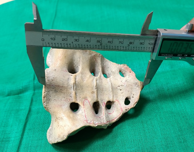 Showing straight length of sacrum