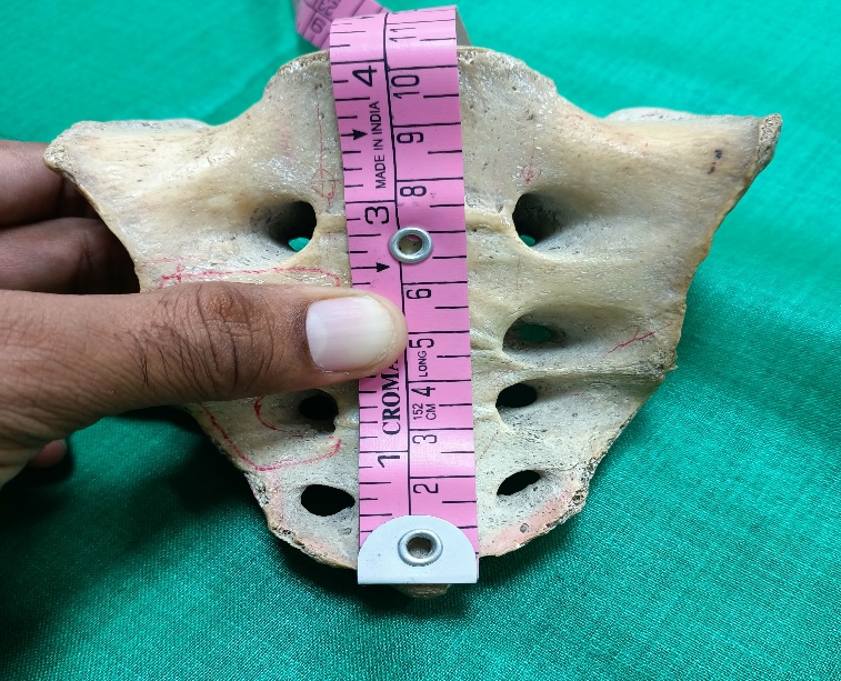 Showing curved length of sacrum
