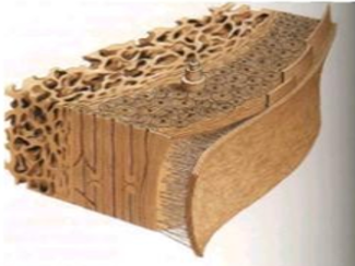 Structure of bone: Cortical bone, Haversian system and harder structure compared to spongy bone with a porous structure.