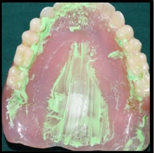 Palatogram 1 