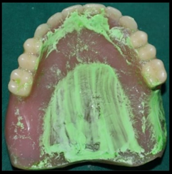 Palatogram 2