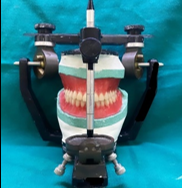 Teeth arrangement