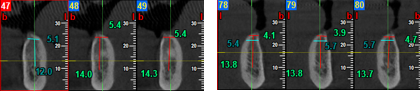 CBCT evaluation