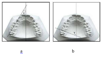 a; Canine rotation measurement, b; Molar rotation measurement