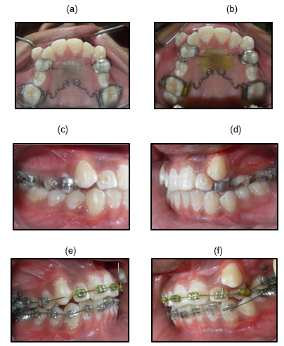 Treatment progress case-1