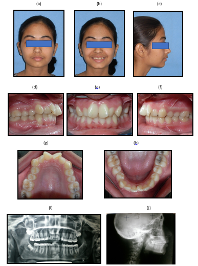 Pre-treatment records case-2