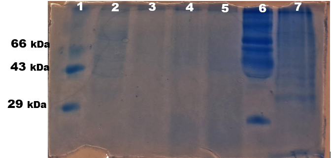 Lane 1: → 25 µl of protein marker, Lane 2 →: 40 µl of control (untreated),