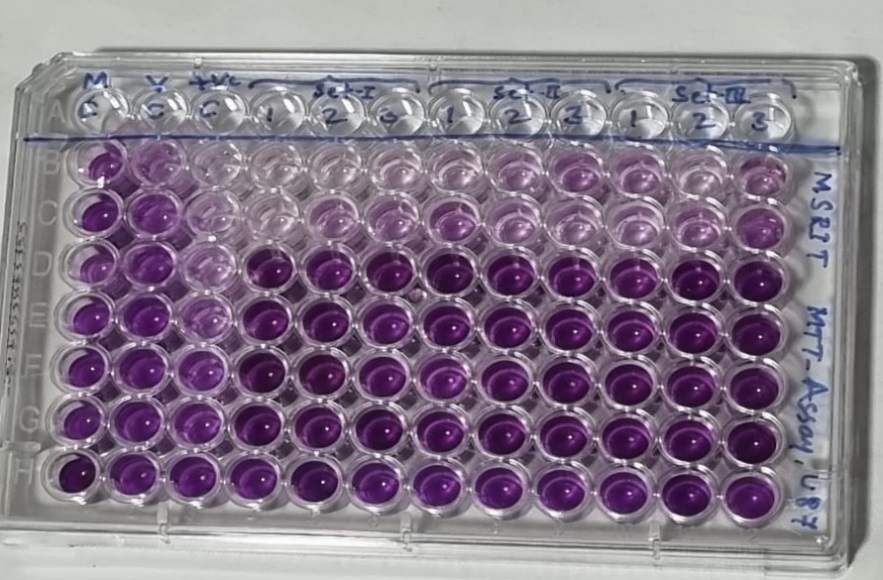 Purple color formazan formation upon reaction of U87-MG cells with MTT and DMSO 
